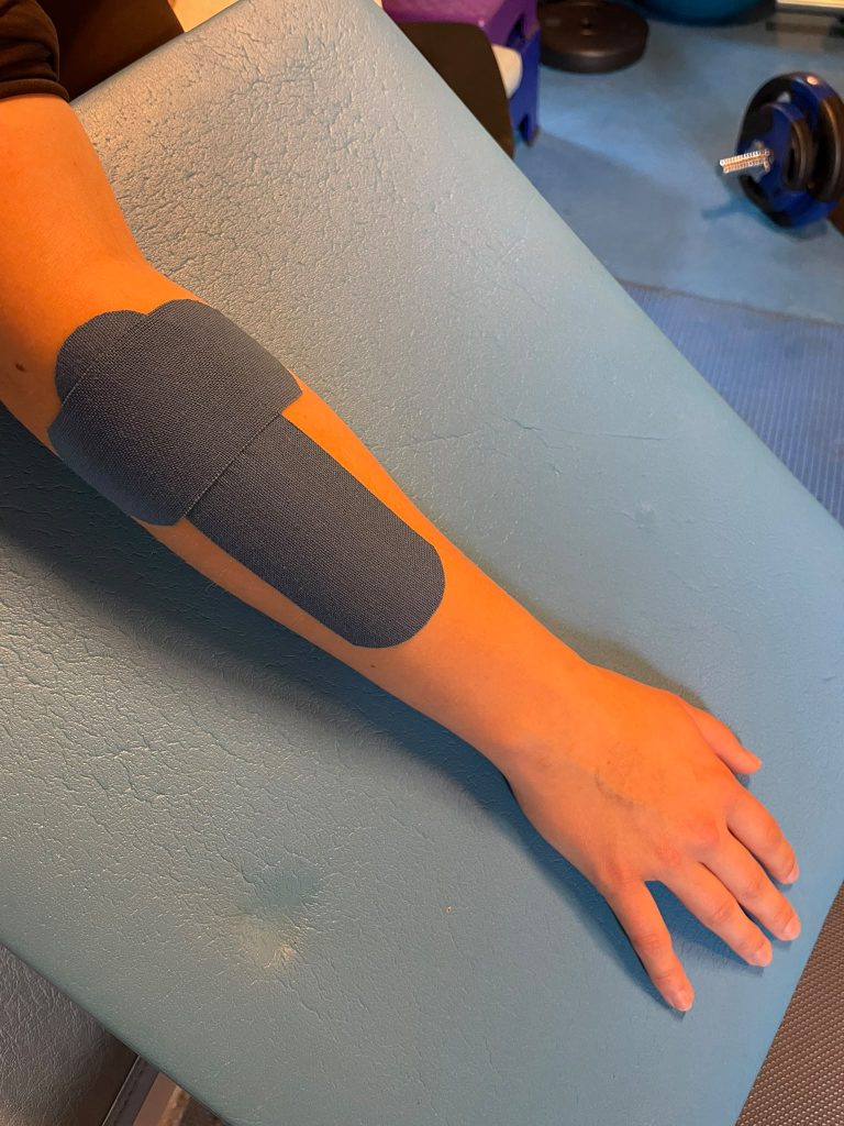 Kinesioteippaus kädessä fysioterapia asiakkaalla